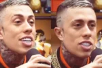 MC Daniel exibe resultado de harmonização facial e divide opiniões nas redes sociais