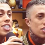 MC Daniel exibe resultado de harmonização facial e divide opiniões nas redes sociais