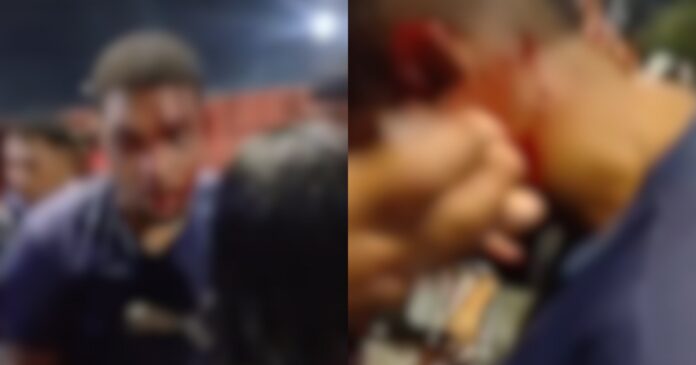 Motociclista é agredido em confusão no entorno do Barradão após jogo do Vasco