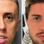 Harmonização facial masculina ganha adesão de famosos e movimenta milhões