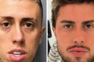 Harmonização facial masculina ganha adesão de famosos e movimenta milhões