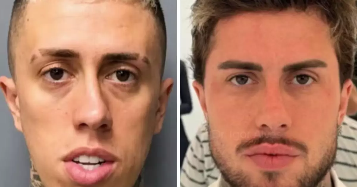 Harmonização facial masculina ganha adesão de famosos e movimenta milhões