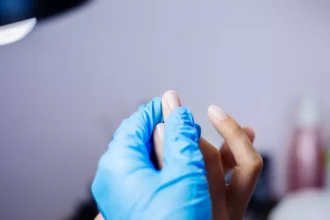 Manchas nas unhas: quando buscar um dermatologista para descartar melanoma