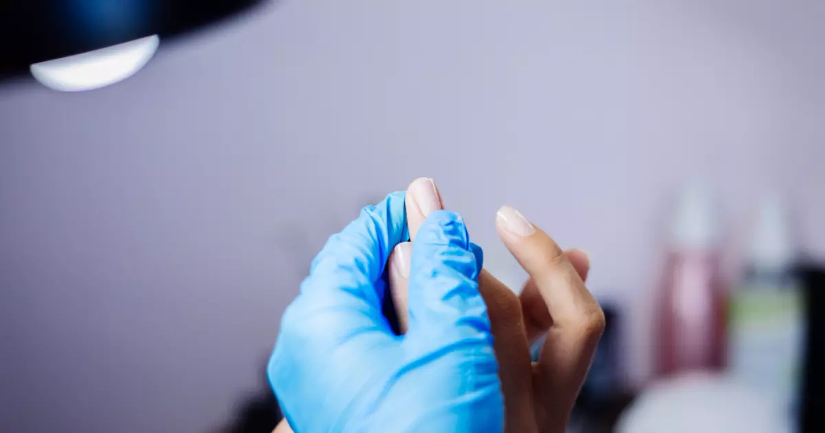 Manchas nas unhas: quando buscar um dermatologista para descartar melanoma