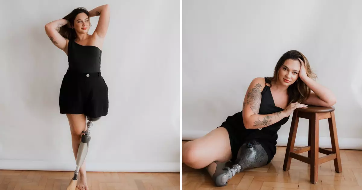 Influencer amputada redefine beleza e empoderamento após acidente na Paulista