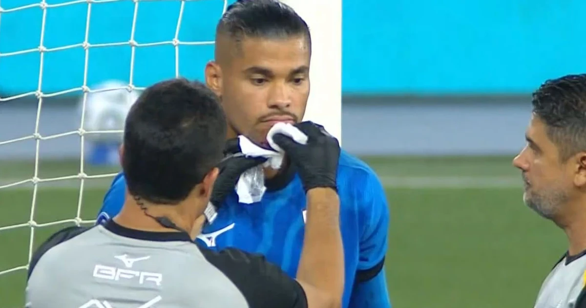 Warleson sofre lesão no queixo e Gabriel Batista estreia pelo Botafogo