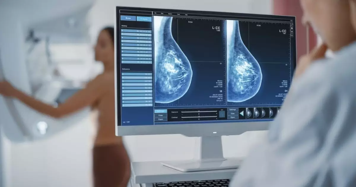 Avanços tecnológicos transformam o tratamento do câncer de mama